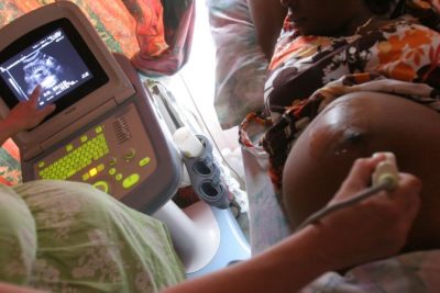The Trump administration said it would prioritize ending mother-to-child HIV transmission. Health workers say it cut services