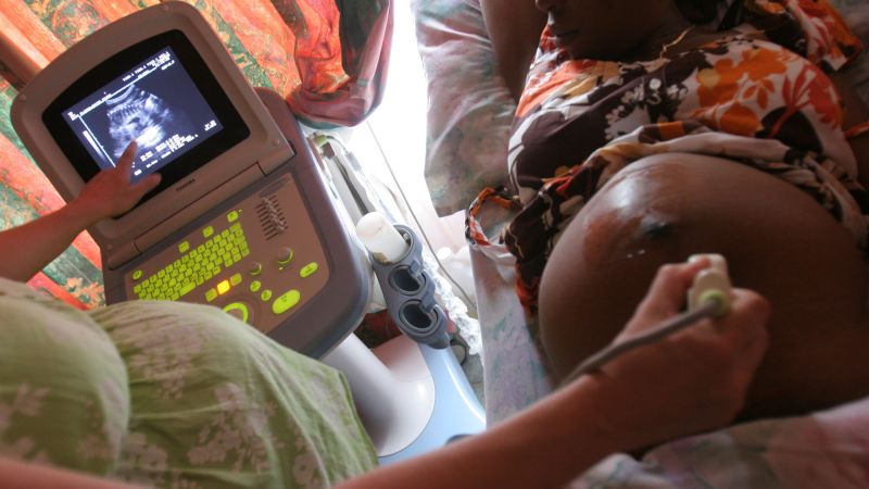 The Trump administration said it would prioritize ending mother-to-child HIV transmission. Health workers say it cut services